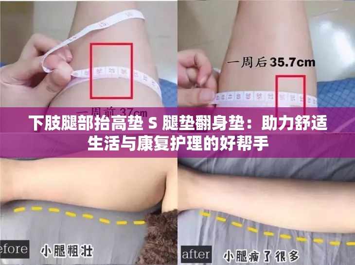 下肢腿部抬高垫 S 腿垫翻身垫：助力舒适生活与康复护理的好帮手