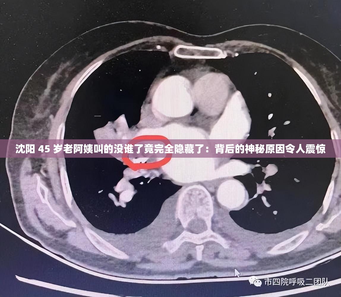 沈阳 45 岁老阿姨叫的没谁了竟完全隐藏了：背后的神秘原因令人震惊