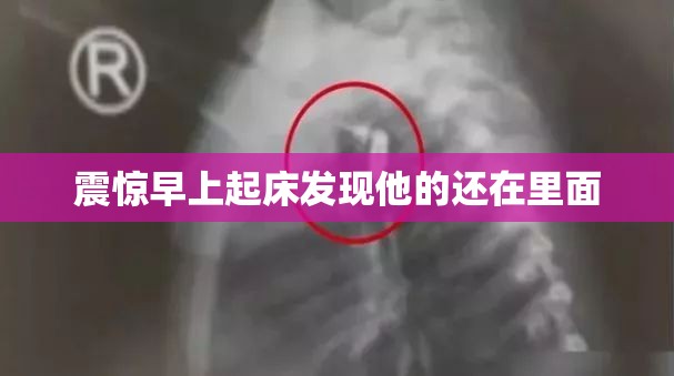 震惊早上起床发现他的还在里面